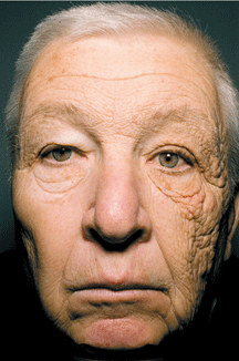 THE UGLY TRUTH: Sun damage is no laughing matter...